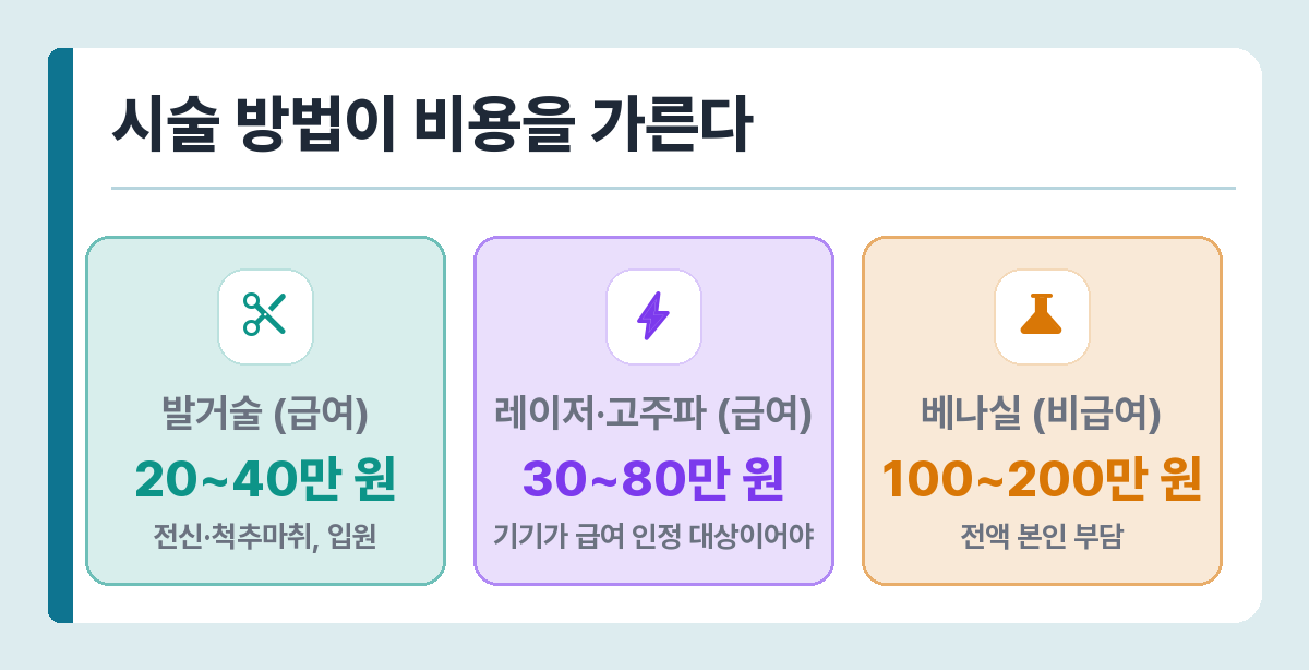 하지정맥류 시술별 비용 — 발거술 20~40만 원, 레이저 30~80만 원, 베나실 100~200만 원
